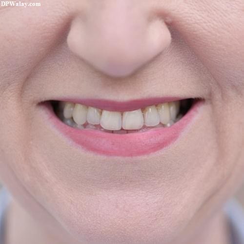 a woman with a missing tooth-mcpT